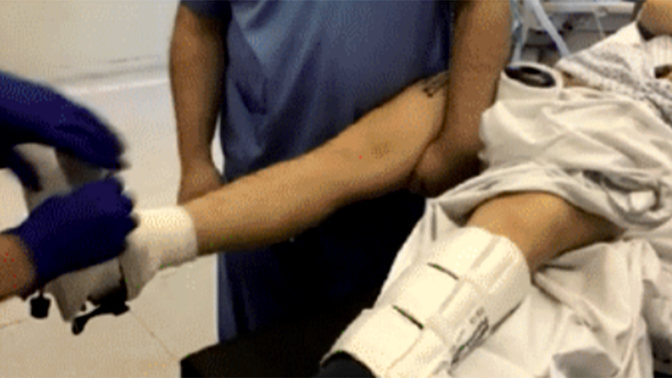 Femoral IM nailing over standard manual training